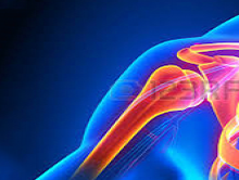 Bolesti ramenního kloubu